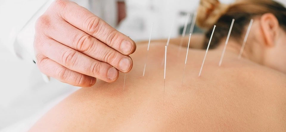 Acupuncture therapy session in Los Gigantes Tenerife